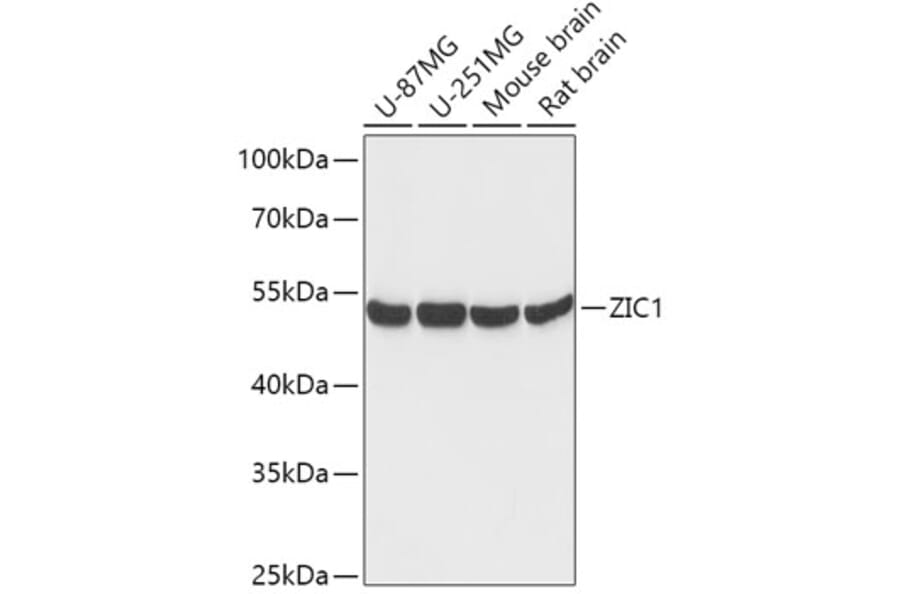 Western Blot - Anti-Zic1 Antibody (A306564) - Antibodies.com