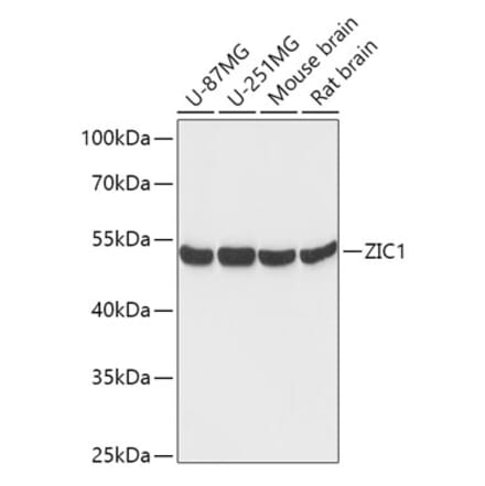 Western Blot - Anti-Zic1 Antibody (A306564) - Antibodies.com