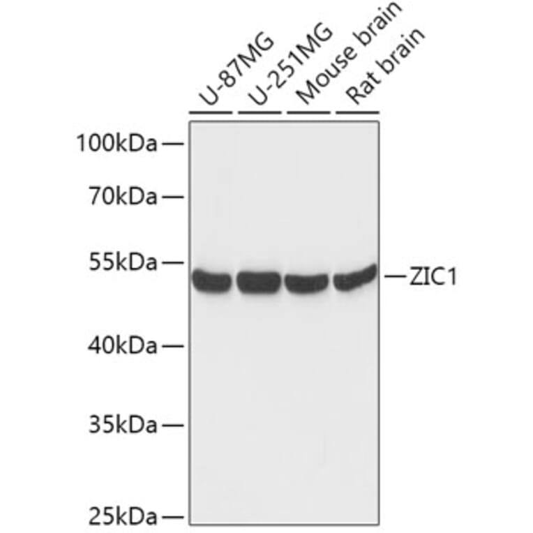 Western Blot - Anti-Zic1 Antibody (A306564) - Antibodies.com