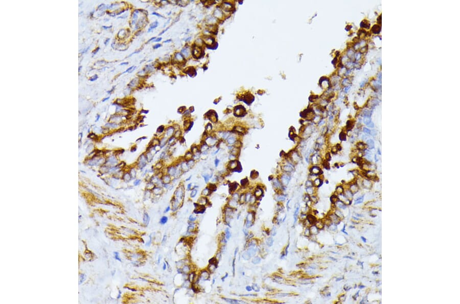Immunohistochemistry - Anti-ITPR2 Antibody (A306567) - Antibodies.com