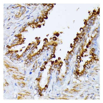 Immunohistochemistry - Anti-ITPR2 Antibody (A306567) - Antibodies.com