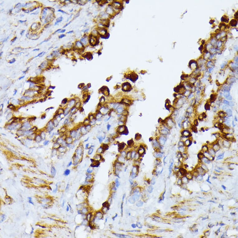 Immunohistochemistry - Anti-ITPR2 Antibody (A306567) - Antibodies.com