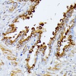 Immunohistochemistry - Anti-ITPR2 Antibody (A306567) - Antibodies.com