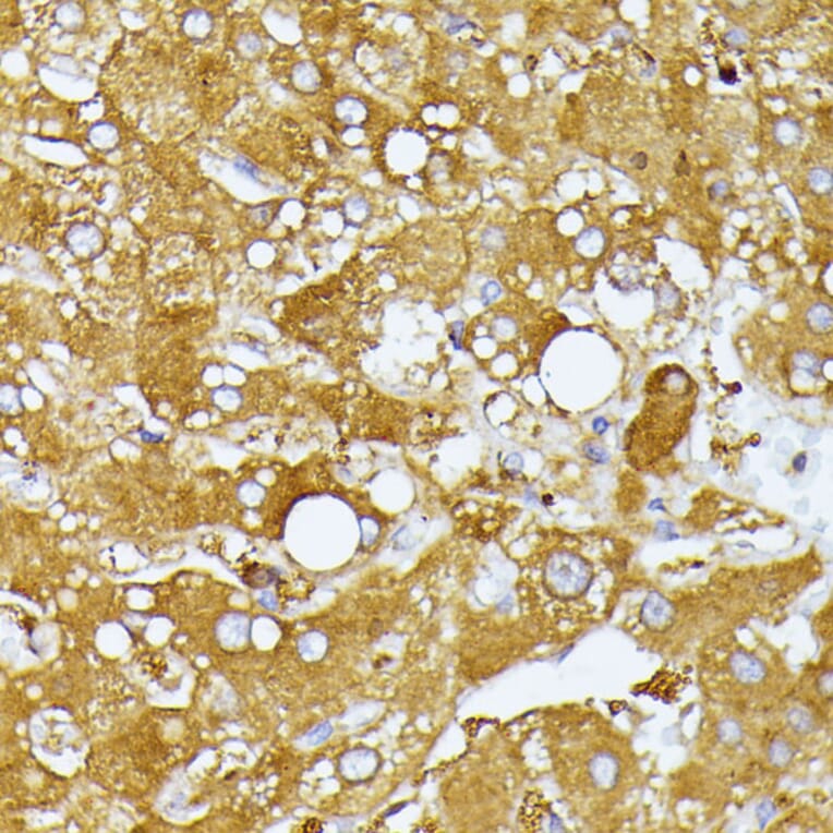 Immunohistochemistry - Anti-ITPR2 Antibody (A306567) - Antibodies.com