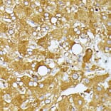 Immunohistochemistry - Anti-ITPR2 Antibody (A306567) - Antibodies.com