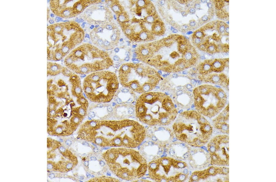 Immunohistochemistry - Anti-ITPR2 Antibody (A306567) - Antibodies.com