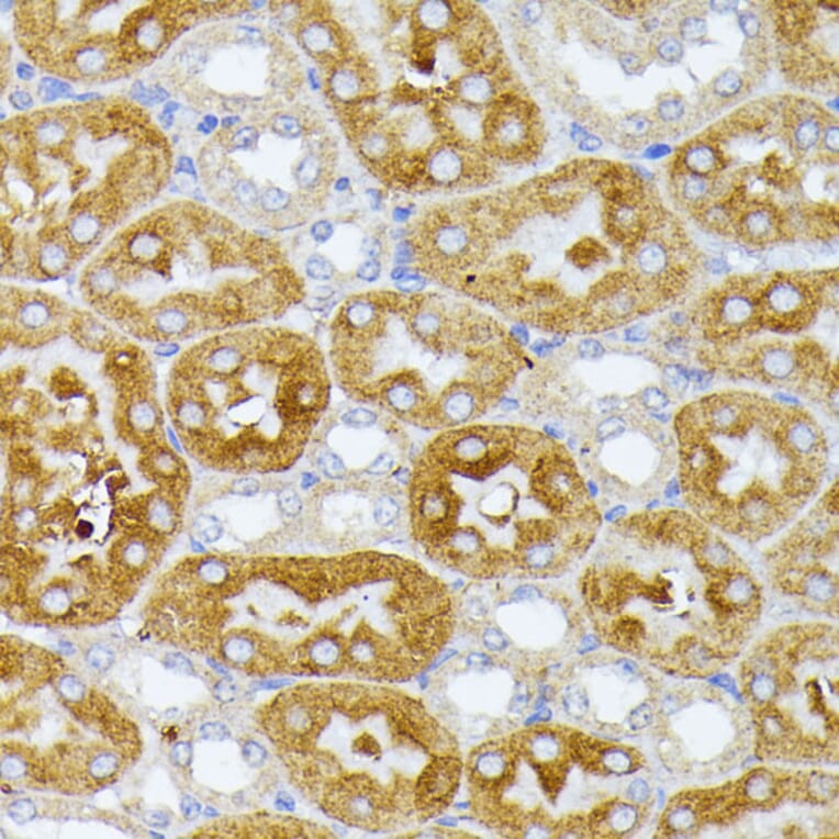 Immunohistochemistry - Anti-ITPR2 Antibody (A306567) - Antibodies.com