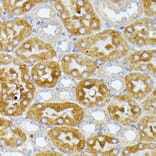 Immunohistochemistry - Anti-ITPR2 Antibody (A306567) - Antibodies.com