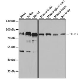 Western Blot - Anti-TTLL12 Antibody (A306568) - Antibodies.com