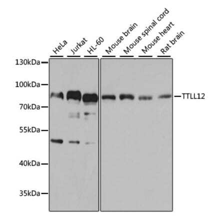 Western Blot - Anti-TTLL12 Antibody (A306568) - Antibodies.com