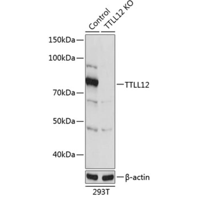 Western Blot - Anti-TTLL12 Antibody (A306569) - Antibodies.com