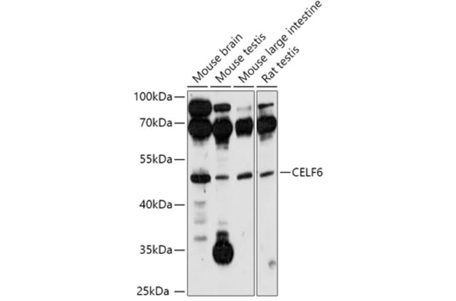 Western Blot - Anti-CELF-6 Antibody (A306570) - Antibodies.com
