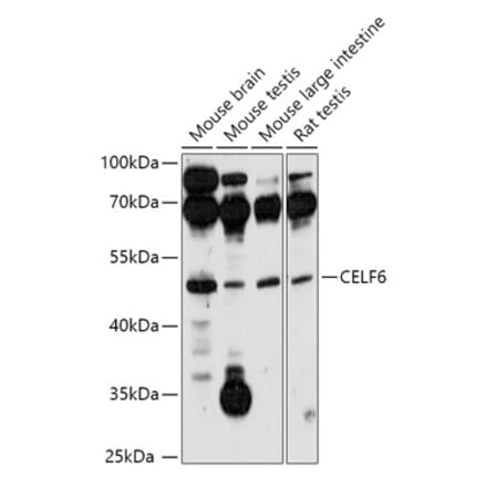 Western Blot - Anti-CELF-6 Antibody (A306570) - Antibodies.com