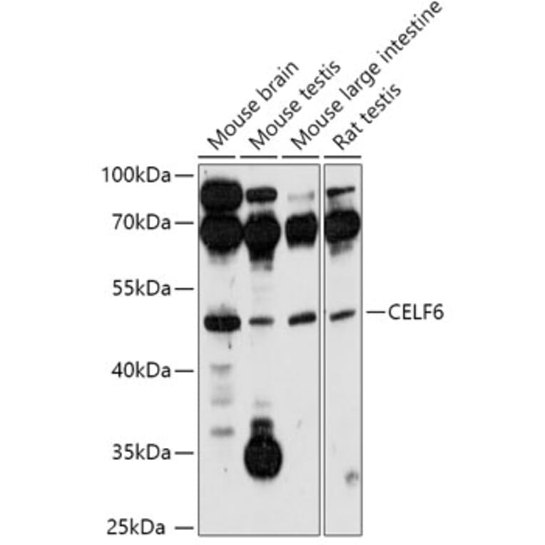 Western Blot - Anti-CELF-6 Antibody (A306570) - Antibodies.com