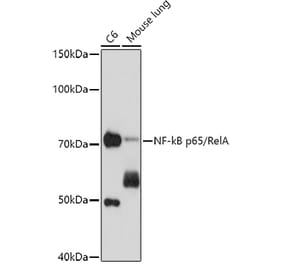 Western Blot - Anti-NF-kB p65 Antibody [AMC0222] (A306571) - Antibodies.com