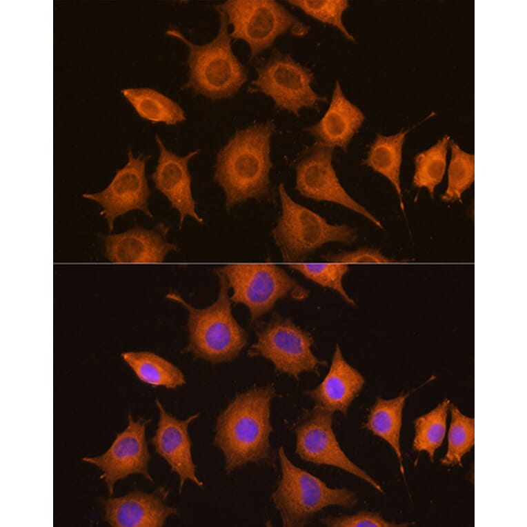 Anti Nf Kb P65 Antibody [amc0222] A306571