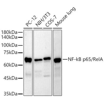 Western Blot - Anti-NF-kB p65 Antibody [ARC51088] (A306572) - Antibodies.com