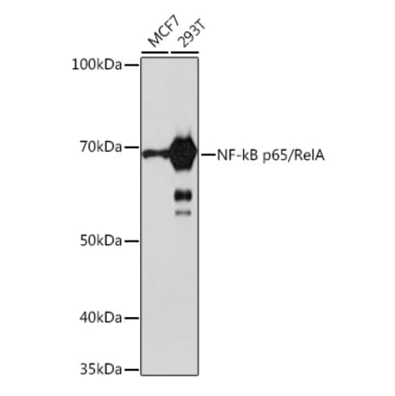 Western Blot - Anti-NF-kB p65 Antibody [ARC51086] (A306573) - Antibodies.com