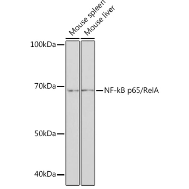 Western Blot - Anti-NF-kB p65 Antibody [ARC51086] (A306573) - Antibodies.com