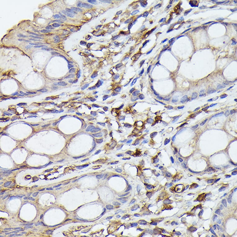 Immunohistochemistry - Anti-NF-kB p65 Antibody [ARC51086] (A306573) - Antibodies.com