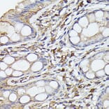 Immunohistochemistry - Anti-NF-kB p65 Antibody [ARC51086] (A306573) - Antibodies.com