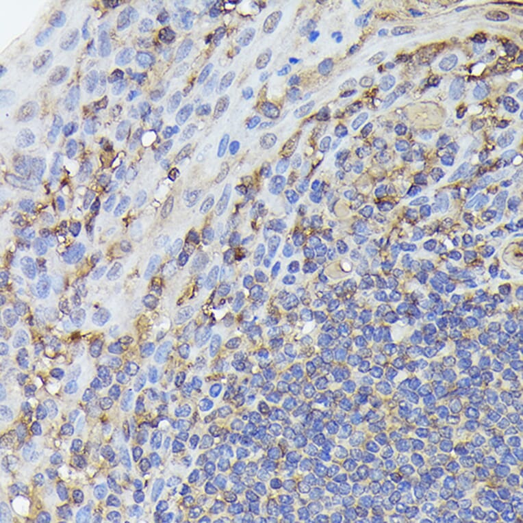 Immunohistochemistry - Anti-NF-kB p65 Antibody [ARC51086] (A306573) - Antibodies.com