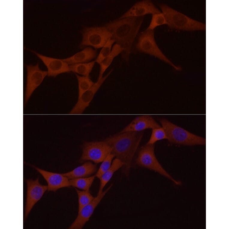 Immunofluorescence - Anti-NF-kB p65 Antibody [ARC51086] (A306573) - Antibodies.com
