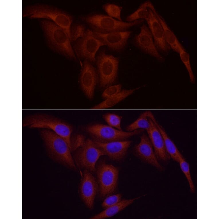 Immunofluorescence - Anti-NF-kB p65 Antibody [ARC51086] (A306573) - Antibodies.com