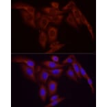 Immunofluorescence - Anti-NF-kB p65 Antibody [ARC51086] (A306573) - Antibodies.com