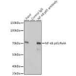 Western Blot - Anti-NF-kB p65 Antibody [ARC51086] (A306573) - Antibodies.com