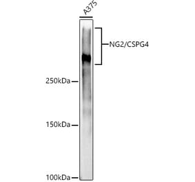 Western Blot - Anti-NG2 Antibody [ARC52162] (A306574) - Antibodies.com
