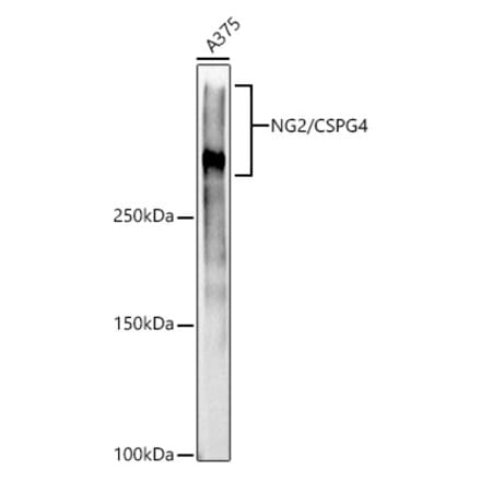 Western Blot - Anti-NG2 Antibody [ARC52162] (A306574) - Antibodies.com