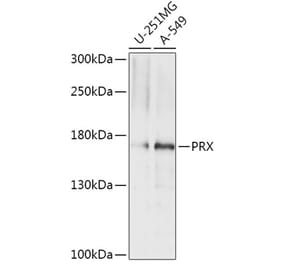 Western Blot - Anti-PRX Antibody (A306576) - Antibodies.com
