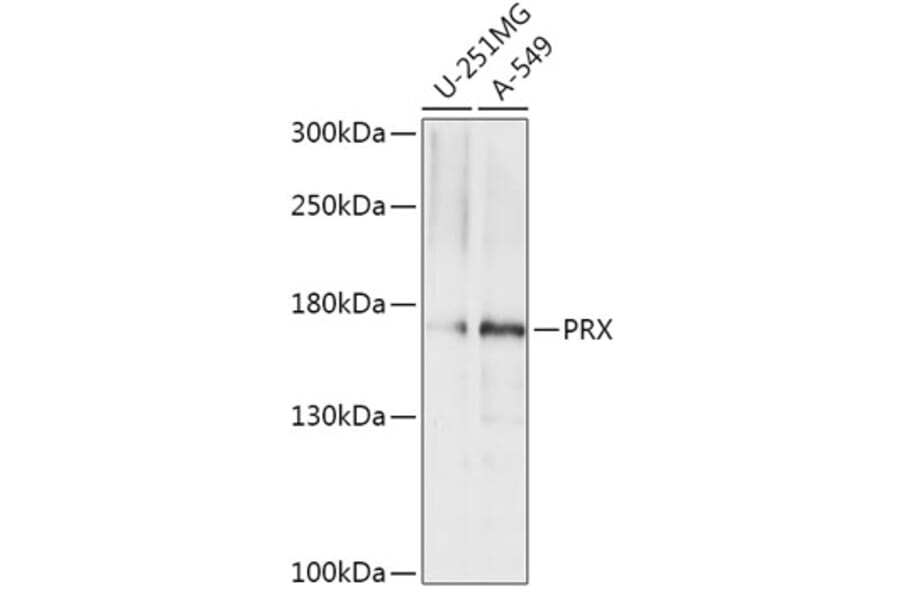 Western Blot - Anti-PRX Antibody (A306576) - Antibodies.com