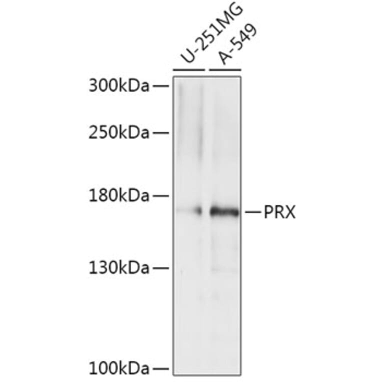 Western Blot - Anti-PRX Antibody (A306576) - Antibodies.com