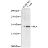 Western Blot - Anti-PRX Antibody (A306576) - Antibodies.com