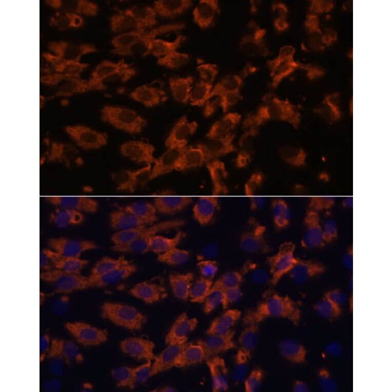 Immunofluorescence - Anti-PRX Antibody (A306576) - Antibodies.com