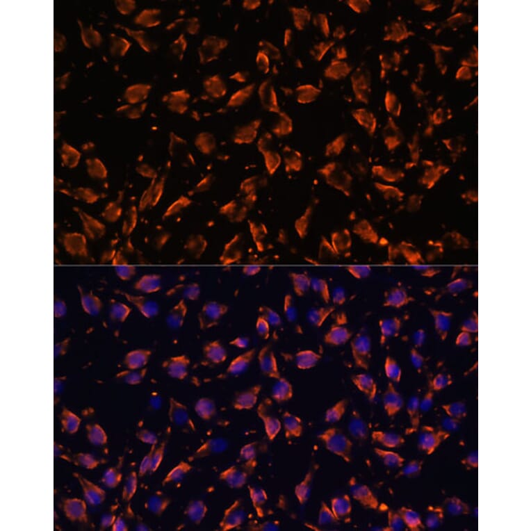 Immunofluorescence - Anti-PRX Antibody (A306576) - Antibodies.com