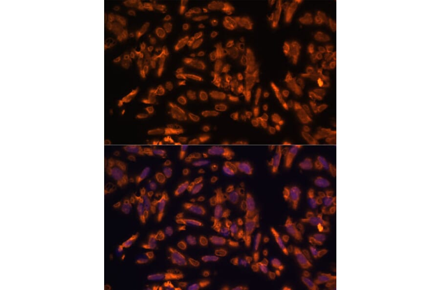 Immunofluorescence - Anti-PRX Antibody (A306576) - Antibodies.com
