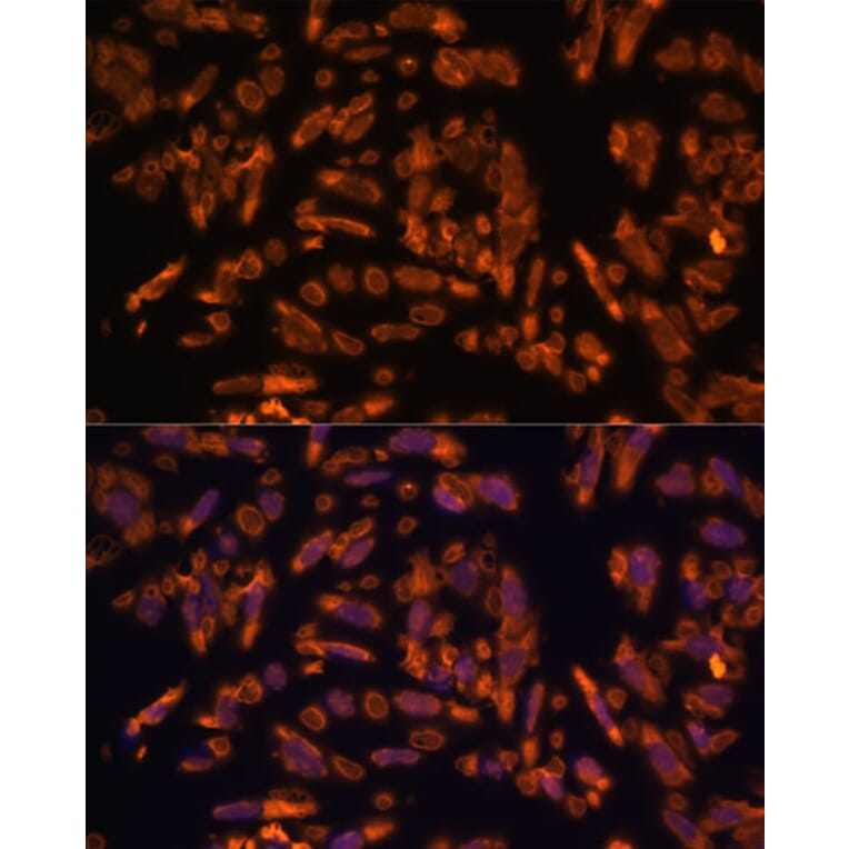 Immunofluorescence - Anti-PRX Antibody (A306576) - Antibodies.com