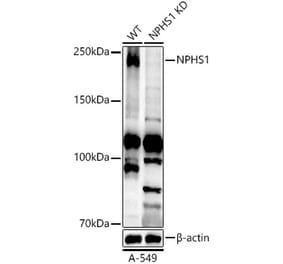 Western Blot - Anti-Nephrin Antibody (A306577) - Antibodies.com