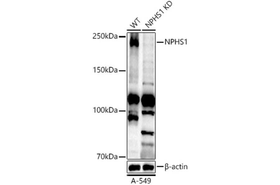 Western Blot - Anti-Nephrin Antibody (A306577) - Antibodies.com