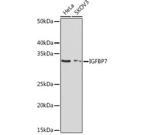 Western Blot - Anti-IGFBP7 Antibody [ARC1052] (A306578) - Antibodies.com