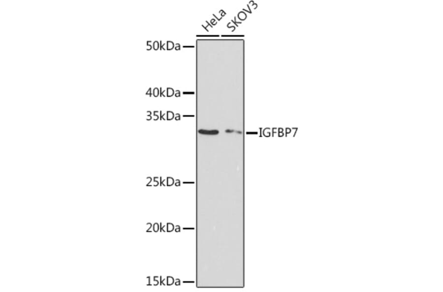 Western Blot - Anti-IGFBP7 Antibody [ARC1052] (A306578) - Antibodies.com