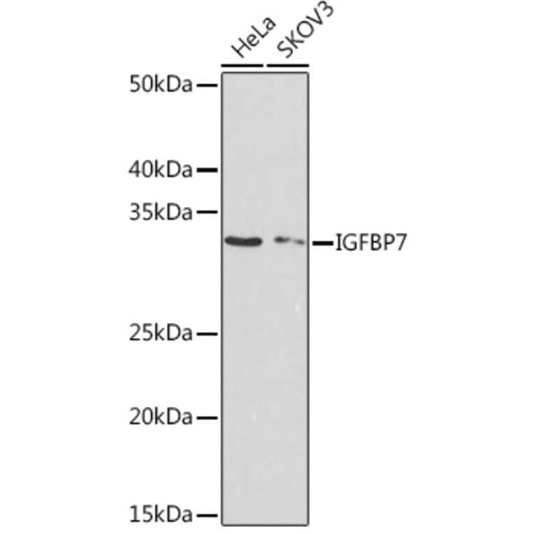 Western Blot - Anti-IGFBP7 Antibody [ARC1052] (A306578) - Antibodies.com