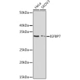 Western Blot - Anti-IGFBP7 Antibody [ARC1052] (A306578) - Antibodies.com