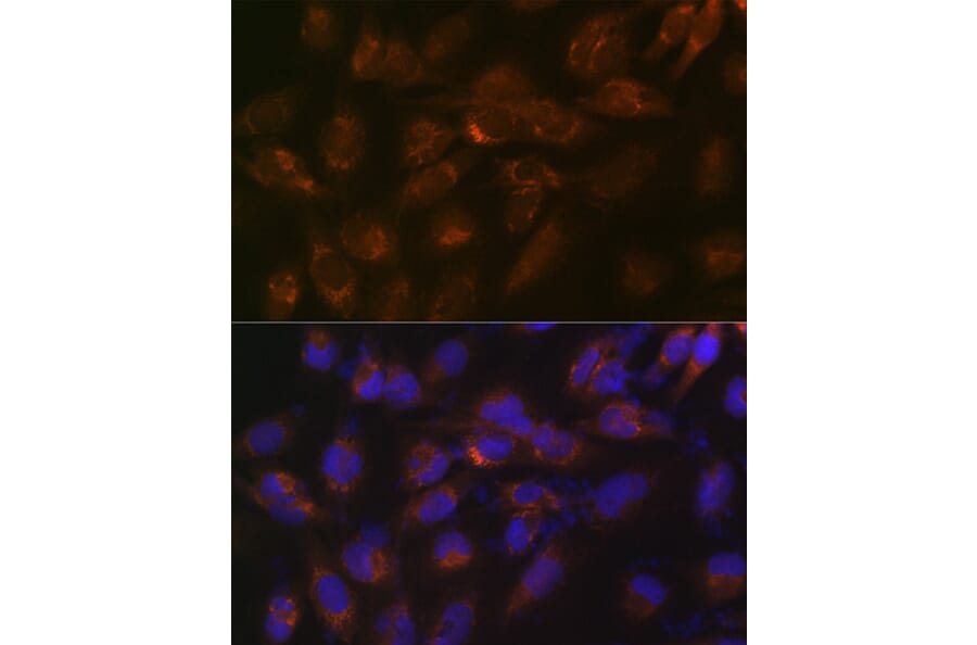 Immunofluorescence - Anti-IGFBP7 Antibody [ARC1052] (A306578) - Antibodies.com
