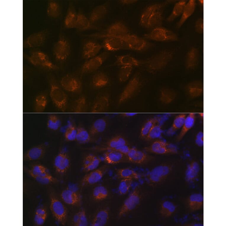 Immunofluorescence - Anti-IGFBP7 Antibody [ARC1052] (A306578) - Antibodies.com