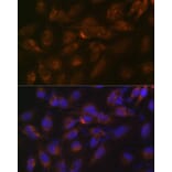 Immunofluorescence - Anti-IGFBP7 Antibody [ARC1052] (A306578) - Antibodies.com