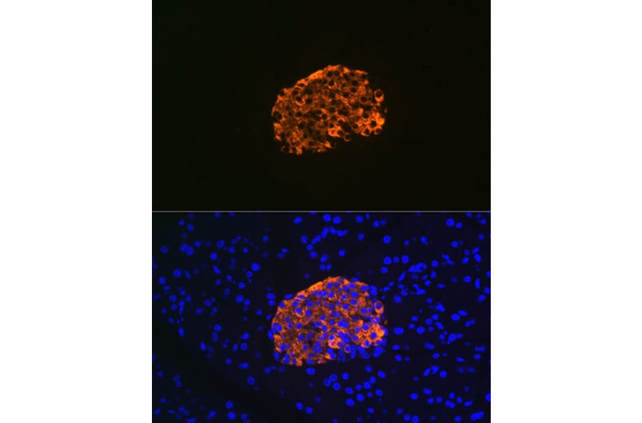Immunofluorescence - Anti-IGFBP7 Antibody [ARC1052] (A306578) - Antibodies.com